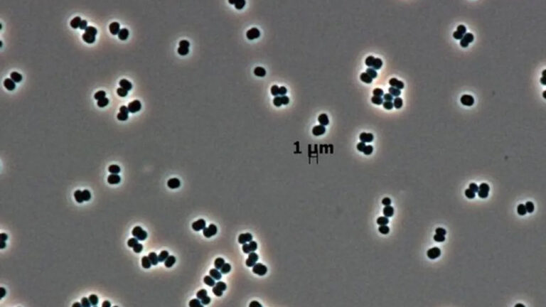olu taklidi yapan super bakteriler uzayi bile tehdit ediyor KGxY9Ptn.jpg