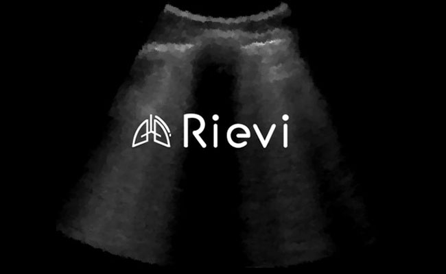 Akciğer Ultrasonunun Yorumlanması