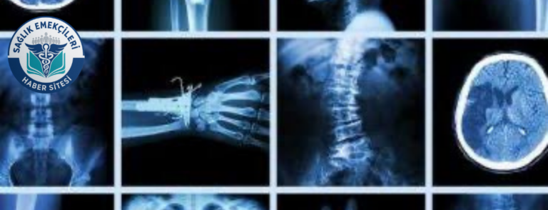 radyoloji-skandali-iddiasi-savcilik-harekete-gecti-yanlis-raporlar-mercek-altinda-saglik-emekcileri-haber-kanali-Wx3X7LBZ.png